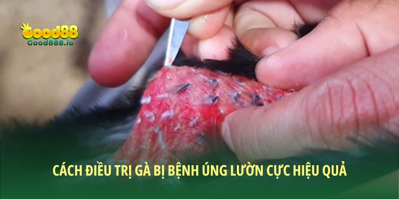 Các cách điều trị cực hiệu quả cho lườn 